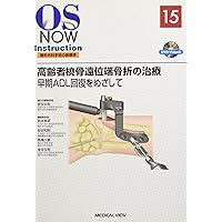 Amazon.co.jp: 橈骨遠位端骨折を究める: 診療の実践 A to Z